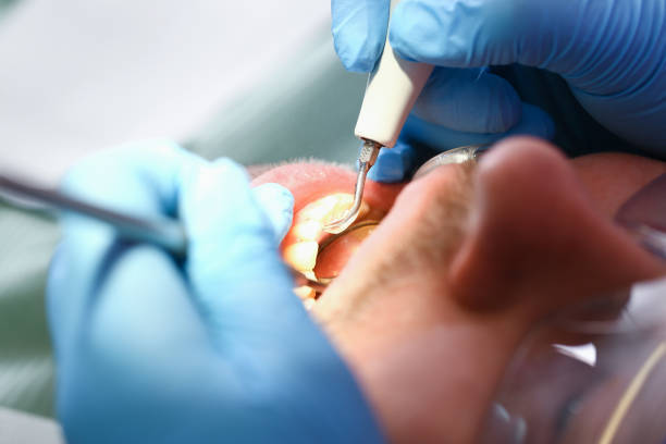 Best Emergency Care for Gum Disease in Vassar, MI